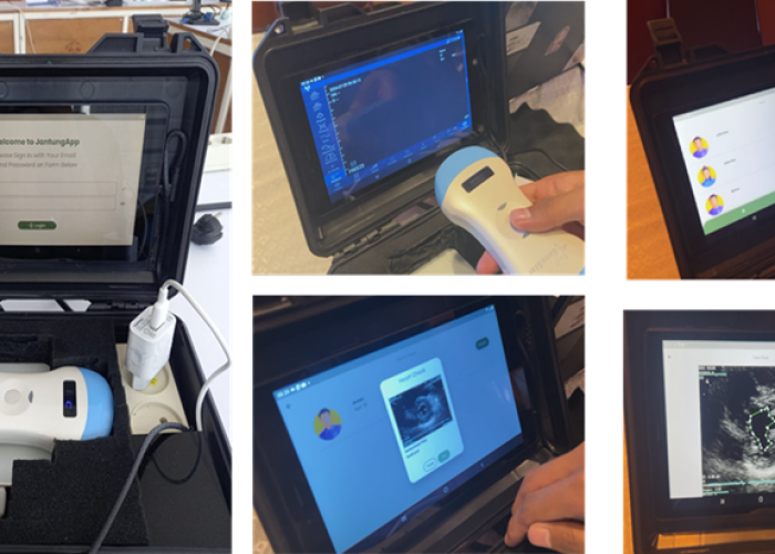 CardioCloud US: Implementasi Ultrasound Portabel Untuk Mendeteksi Penyakit Jantung Menggunakan Machine Learning Berbasis Cloud Computing