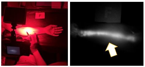 Kamera Near Infrared (NIR) Modifikasi untuk Pencitraan Fluoresens